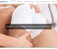 https://www.arthrose-genou.fr